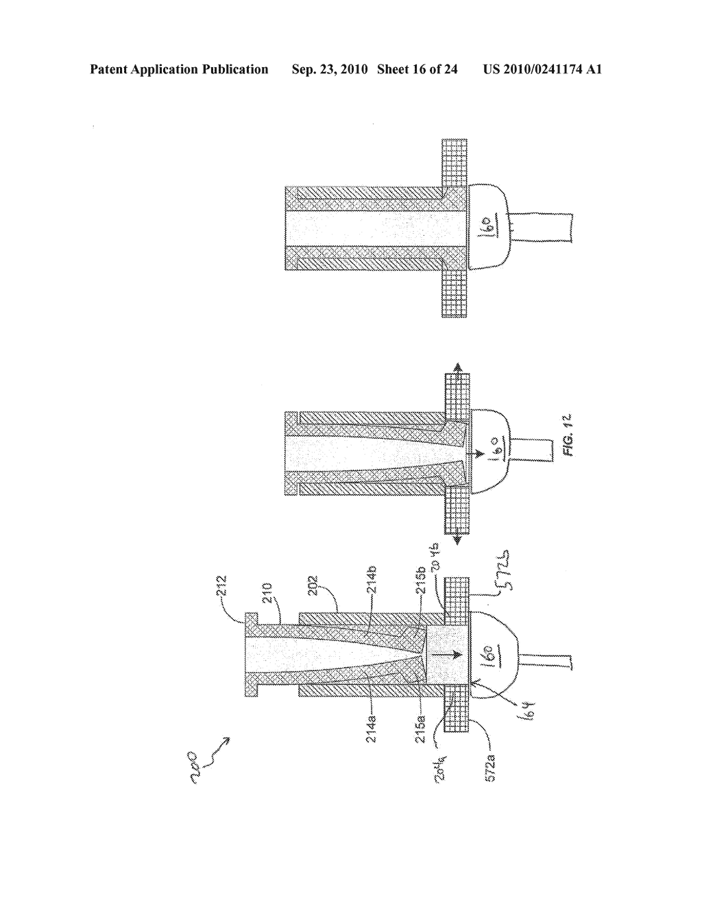 BONE SCREW RETAINING AND REMOVAL SYSTEM - diagram, schematic, and image 17