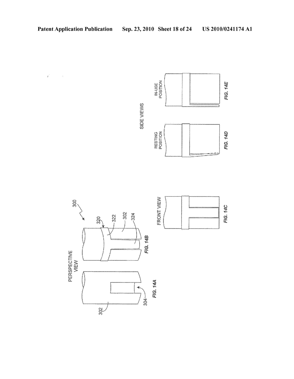 BONE SCREW RETAINING AND REMOVAL SYSTEM - diagram, schematic, and image 19