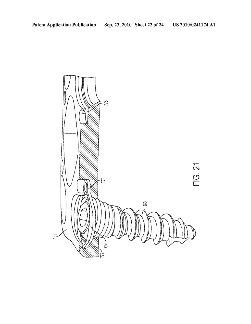 BONE SCREW RETAINING AND REMOVAL SYSTEM - diagram, schematic, and image 23