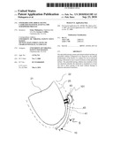 STEERABLE EPICARDIAL PACING CATHETER SYSTEM PLACED VIA THE SUBXIPHOID PROCESS diagram and image