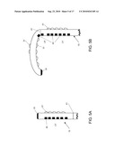 STEERABLE EPICARDIAL PACING CATHETER SYSTEM PLACED VIA THE SUBXIPHOID PROCESS diagram and image