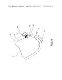 STEERABLE EPICARDIAL PACING CATHETER SYSTEM PLACED VIA THE SUBXIPHOID PROCESS diagram and image