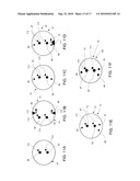 STEERABLE EPICARDIAL PACING CATHETER SYSTEM PLACED VIA THE SUBXIPHOID PROCESS diagram and image