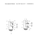 STEERABLE EPICARDIAL PACING CATHETER SYSTEM PLACED VIA THE SUBXIPHOID PROCESS diagram and image