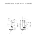 STEERABLE EPICARDIAL PACING CATHETER SYSTEM PLACED VIA THE SUBXIPHOID PROCESS diagram and image