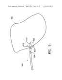 Percutaneous Electrical Treatment Of Tissue diagram and image