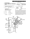 SYSTEM AND METHOD FOR DEPLOYING A PROXIMALLY-FLARING STENT diagram and image