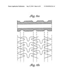 STENTS FOR ANGIOPLASTY diagram and image