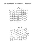 STENTS FOR ANGIOPLASTY diagram and image
