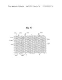 Stent diagram and image