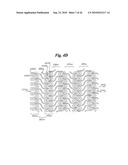 Stent diagram and image