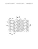 Stent diagram and image