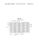 Stent diagram and image