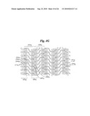 Stent diagram and image