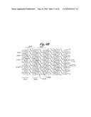 Stent diagram and image