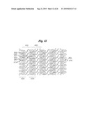 Stent diagram and image