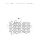 Stent diagram and image