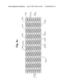 Stent diagram and image