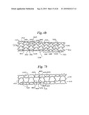 Stent diagram and image