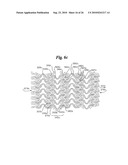 Stent diagram and image