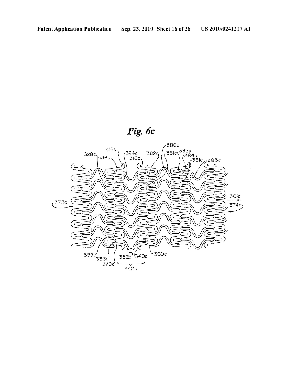 Stent - diagram, schematic, and image 17