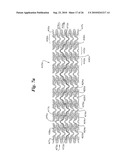 Stent diagram and image