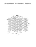 Stent diagram and image