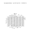 Stent diagram and image