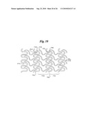 Stent diagram and image