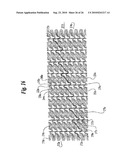 Stent diagram and image