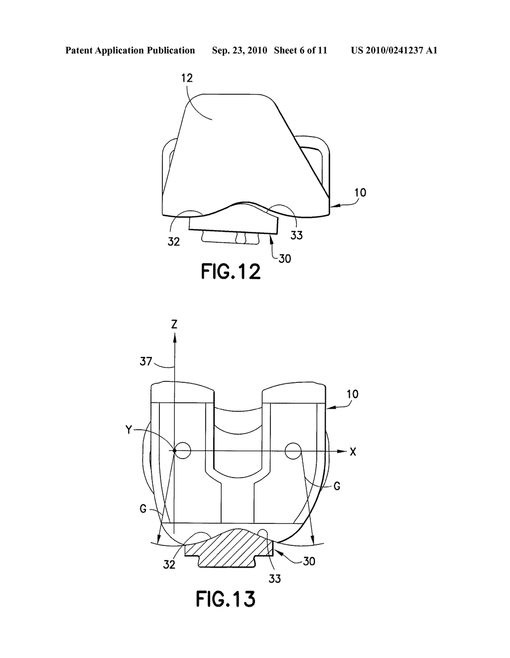 FIXED BEARING JOINT ENDOPROSTHESIS WITH COMBINED CONGRUENT - INCONGRUENT PROSTHETIC ARTICULATIONS - diagram, schematic, and image 07