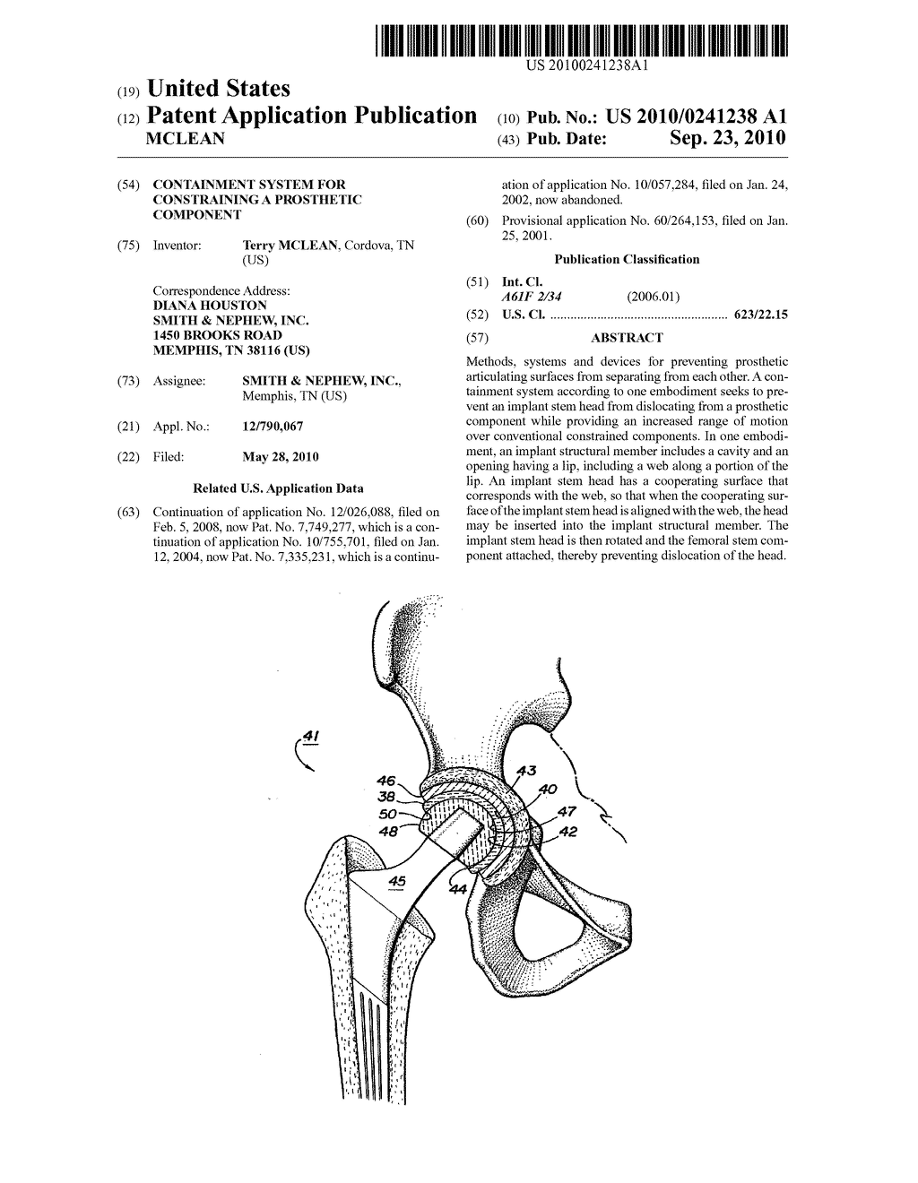 CONTAINMENT SYSTEM FOR CONSTRAINING A PROSTHETIC COMPONENT - diagram, schematic, and image 01