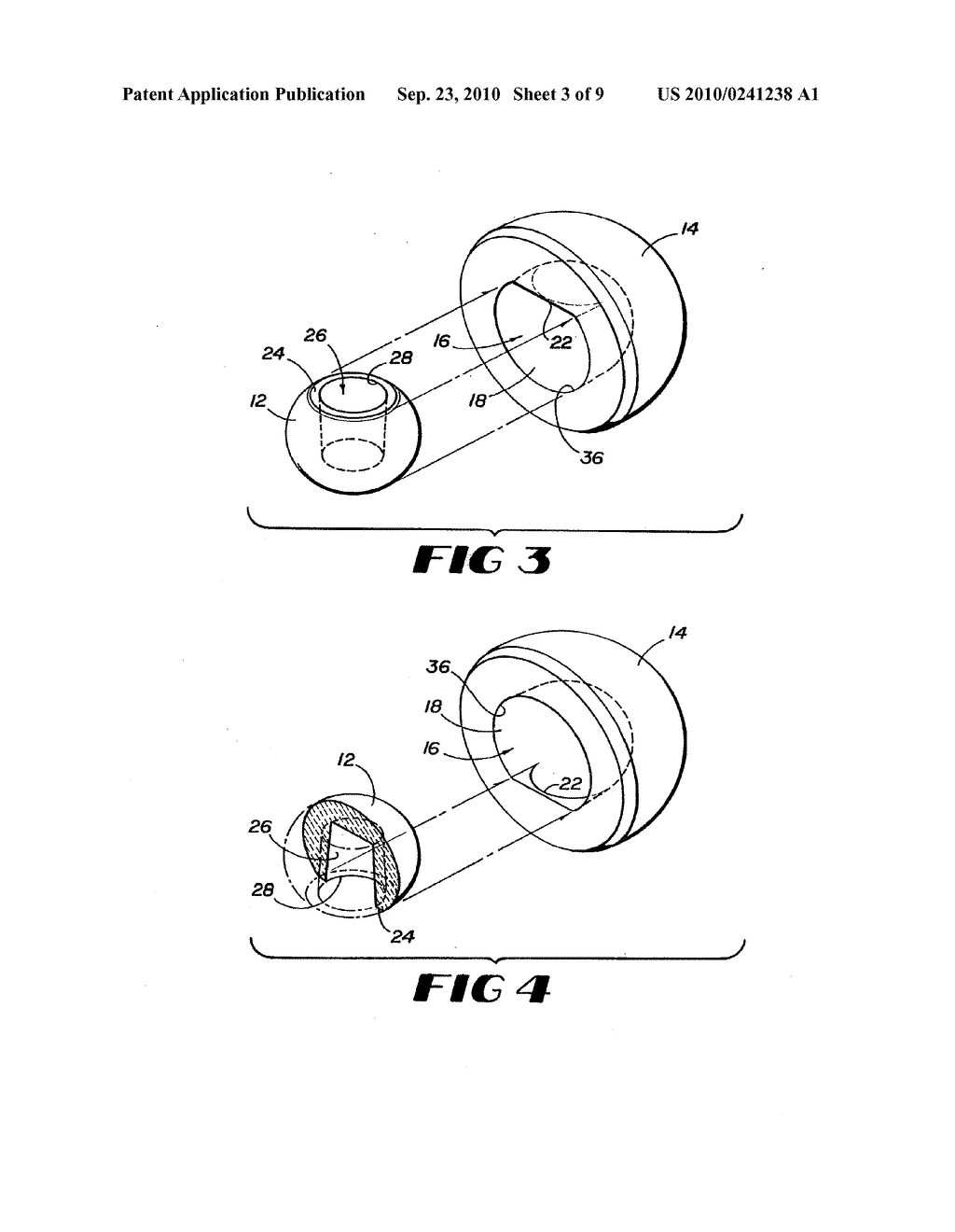 CONTAINMENT SYSTEM FOR CONSTRAINING A PROSTHETIC COMPONENT - diagram, schematic, and image 04