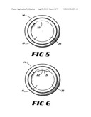 CONTAINMENT SYSTEM FOR CONSTRAINING A PROSTHETIC COMPONENT diagram and image