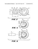 CONTAINMENT SYSTEM FOR CONSTRAINING A PROSTHETIC COMPONENT diagram and image