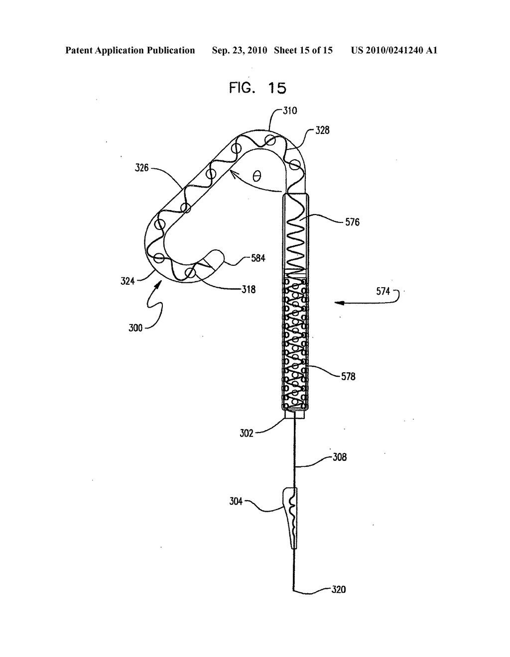 SELF-ADJUSTING ENDOURETHRAL DEVICE & METHODS OF USE - diagram, schematic, and image 16