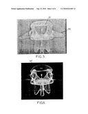 Osteo-Articular Structure diagram and image