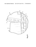 FIELD FORMABLE STEP NOSE SYSTEM diagram and image