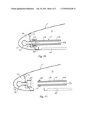 AIR INTAKE STRUCTURE TO BE MOUNTED UPSTREAM OF A NACELLE MIDDLE STRUCTURE FOR AIRCRAFT ENGINE, AND NACELLE EQUIPPED WITH SUCH AIR INTAKE STRUCTURE diagram and image