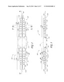 WRISTWATCH BAND WITH LONGITUDINAL, TRANSVERSE AND TORSIONAL FLEXIBILITY diagram and image