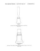 Neutral Displacement Wick diagram and image