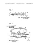 RF coil assembly for MRI using differently shaped and/or sized coils diagram and image