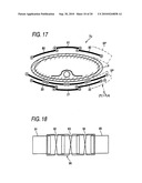 RF coil assembly for MRI using differently shaped and/or sized coils diagram and image