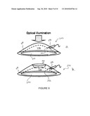 SYSTEMS AND METHODS FOR PHOTOACOUSTIC OPTHALMOSCOPY diagram and image