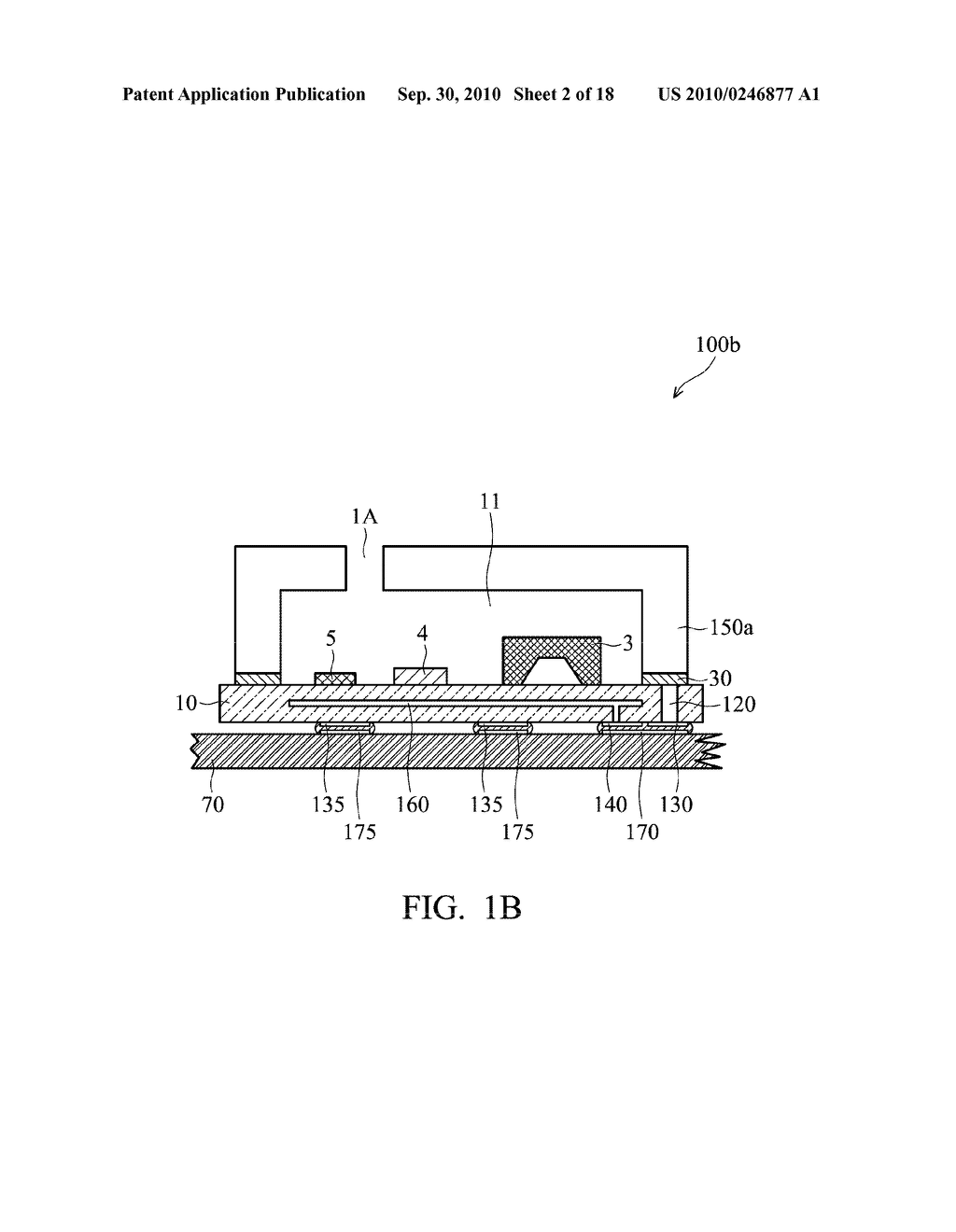 Miniature MEMS Condenser Microphone Package and Fabrication Method Thereof - diagram, schematic, and image 03