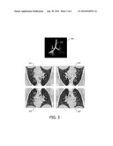 METHOD OF AUTOMATICALLY CORRECTING MIS-ORIENTATION OF MEDICAL IMAGES diagram and image