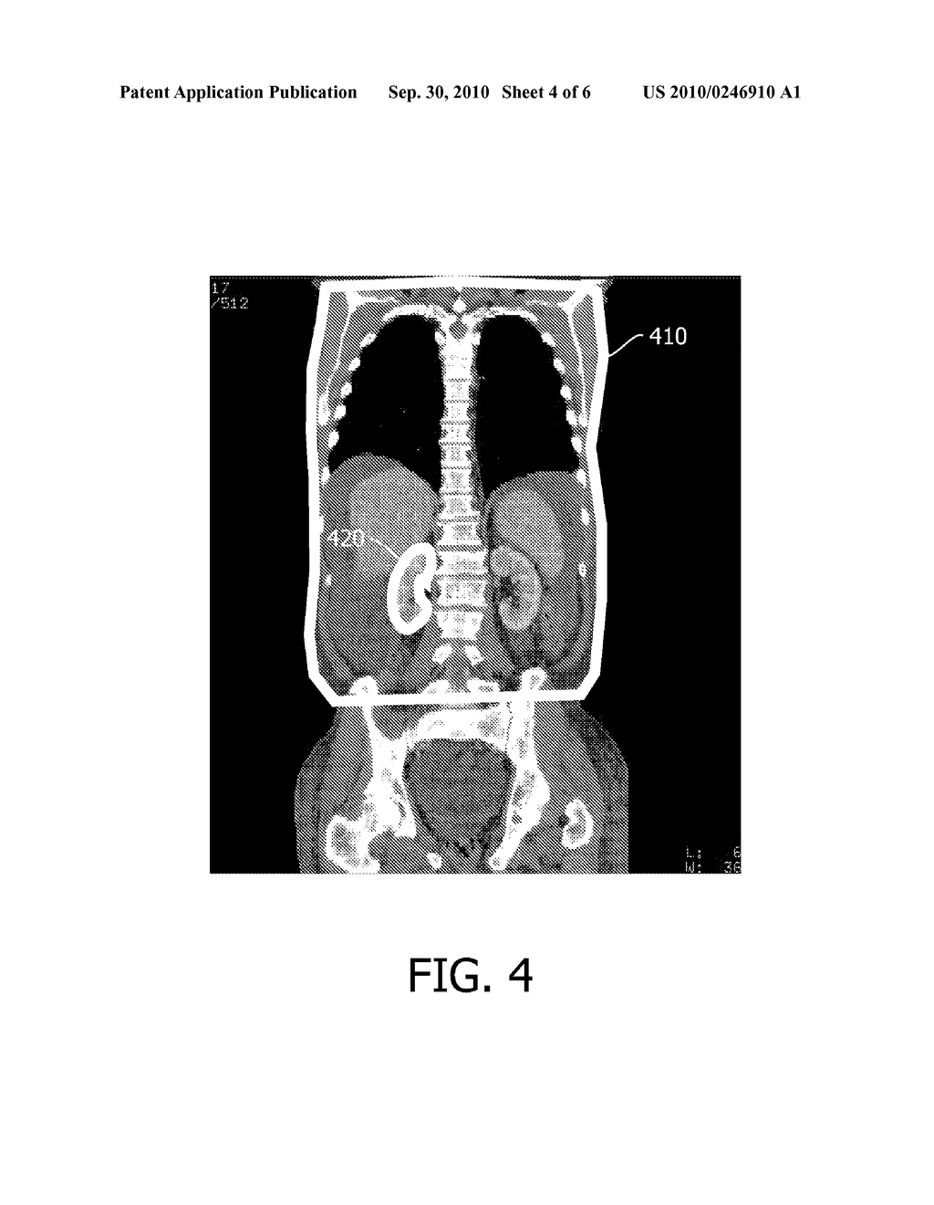 METHOD OF AUTOMATICALLY CORRECTING MIS-ORIENTATION OF MEDICAL IMAGES - diagram, schematic, and image 05