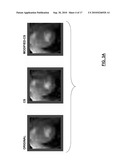 RECURSIVE SPARSE RECONSTRUCTION diagram and image