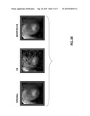 RECURSIVE SPARSE RECONSTRUCTION diagram and image