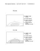 MAMMARY GLAND CONTENT RATE ESTIMATING APPARATUS, METHOD AND RECORDING MEDIUM diagram and image